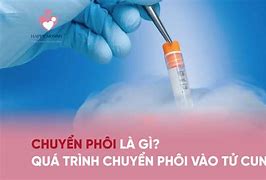 Quá Trình Chuyển Phôi Mất Bao Lâu